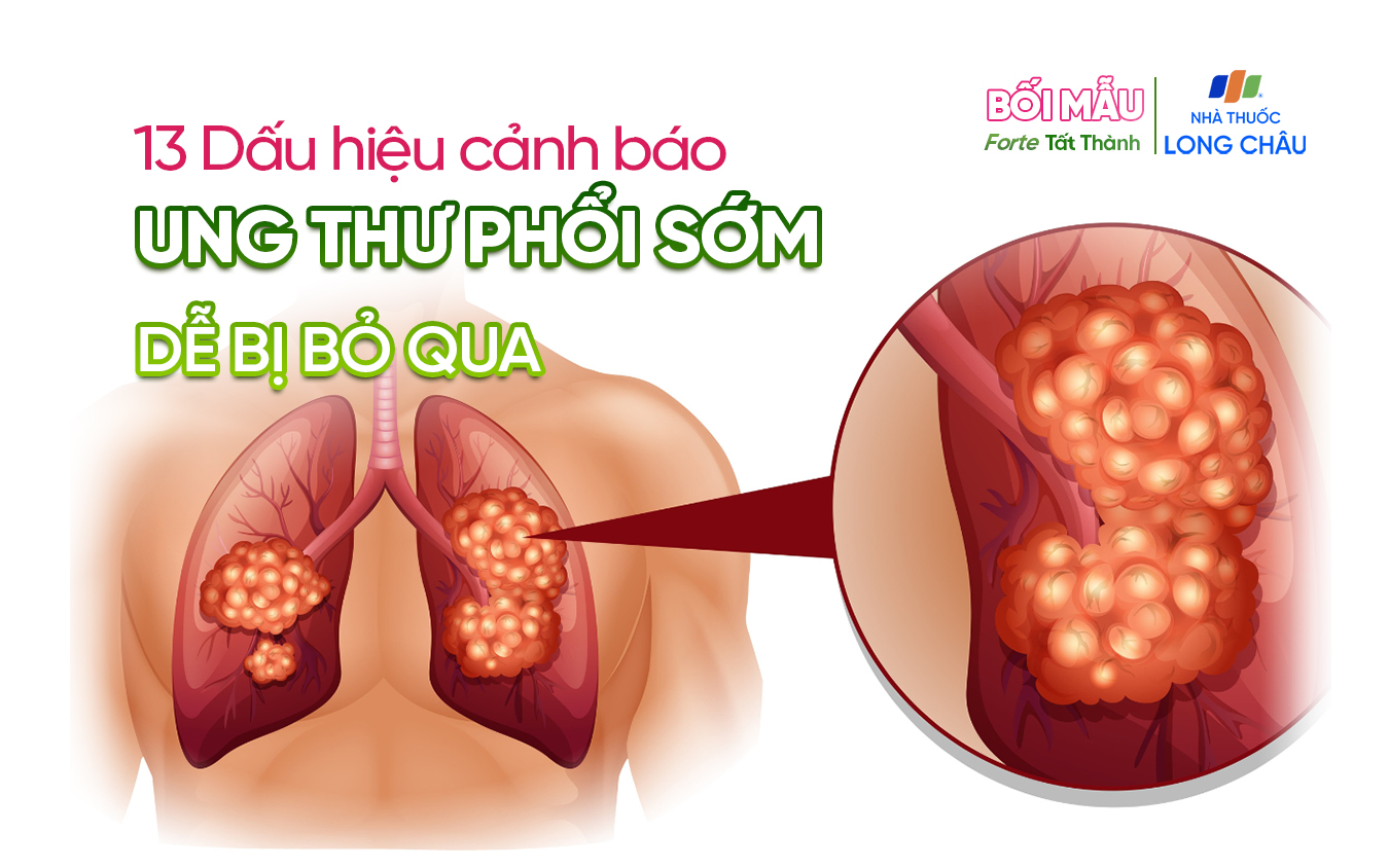 13 dấu hiệu ung thư phổi bạn tuyệt đối không nên bỏ qua