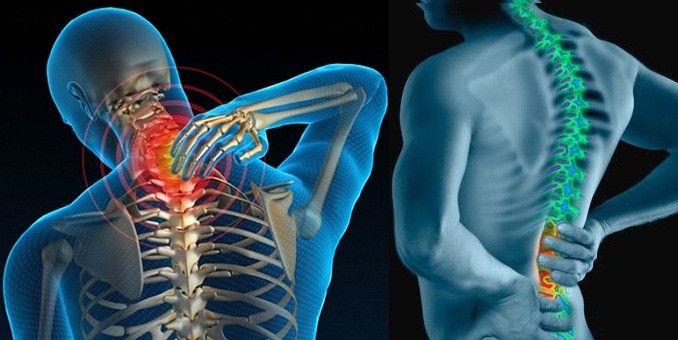 Đau nhức mỏi cổ - vai - gáy