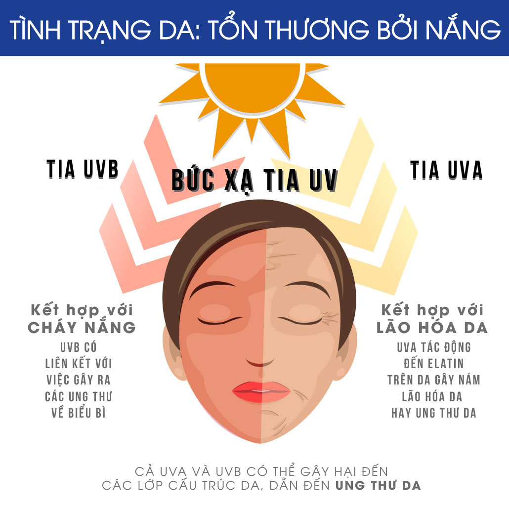 Don-He-2026-Xu-Huong-Chong-Nang-Nang-Tone-Thay-Kem-Nen-3.png