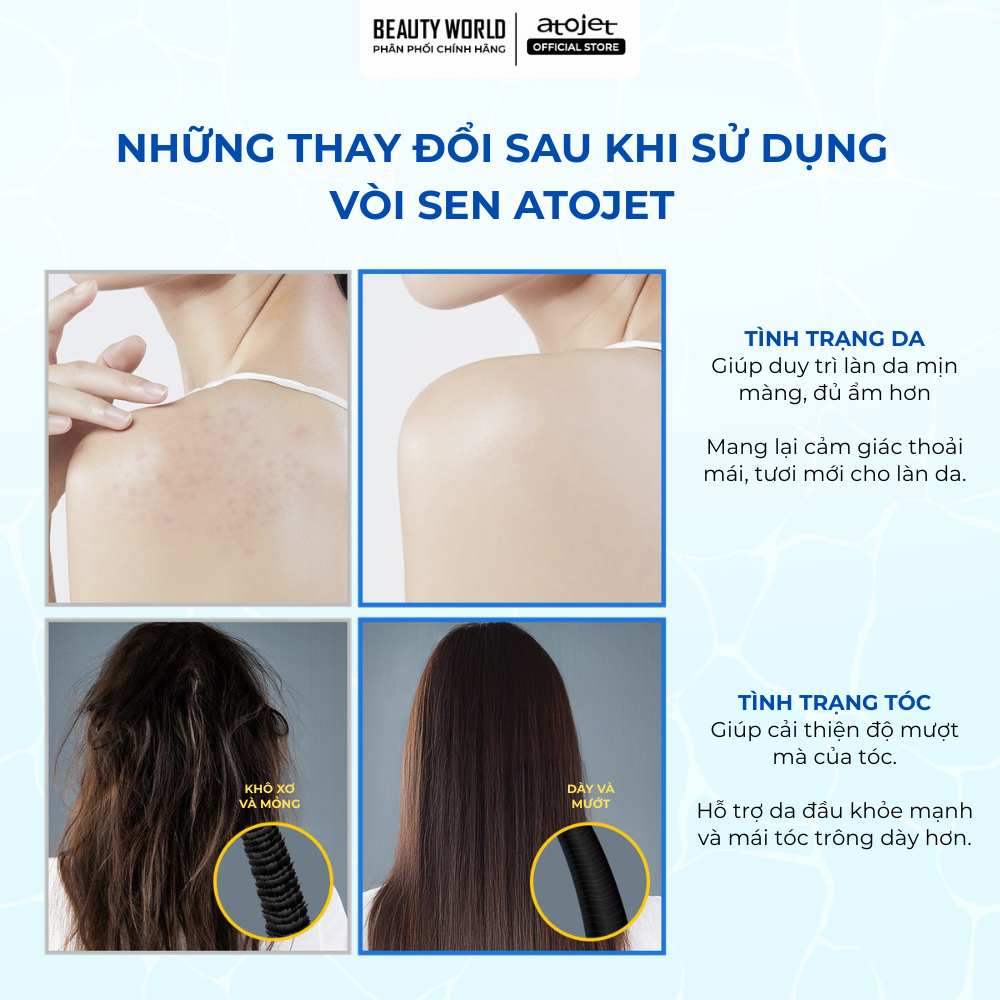 Voi-Sen-Loc-Nuoc-Atojet-JNE-300-Bi-Mat-Giu-Da-Min-Toc-Muot-Tu-Nguon-Nuoc-Moi-Ngay-3.png
