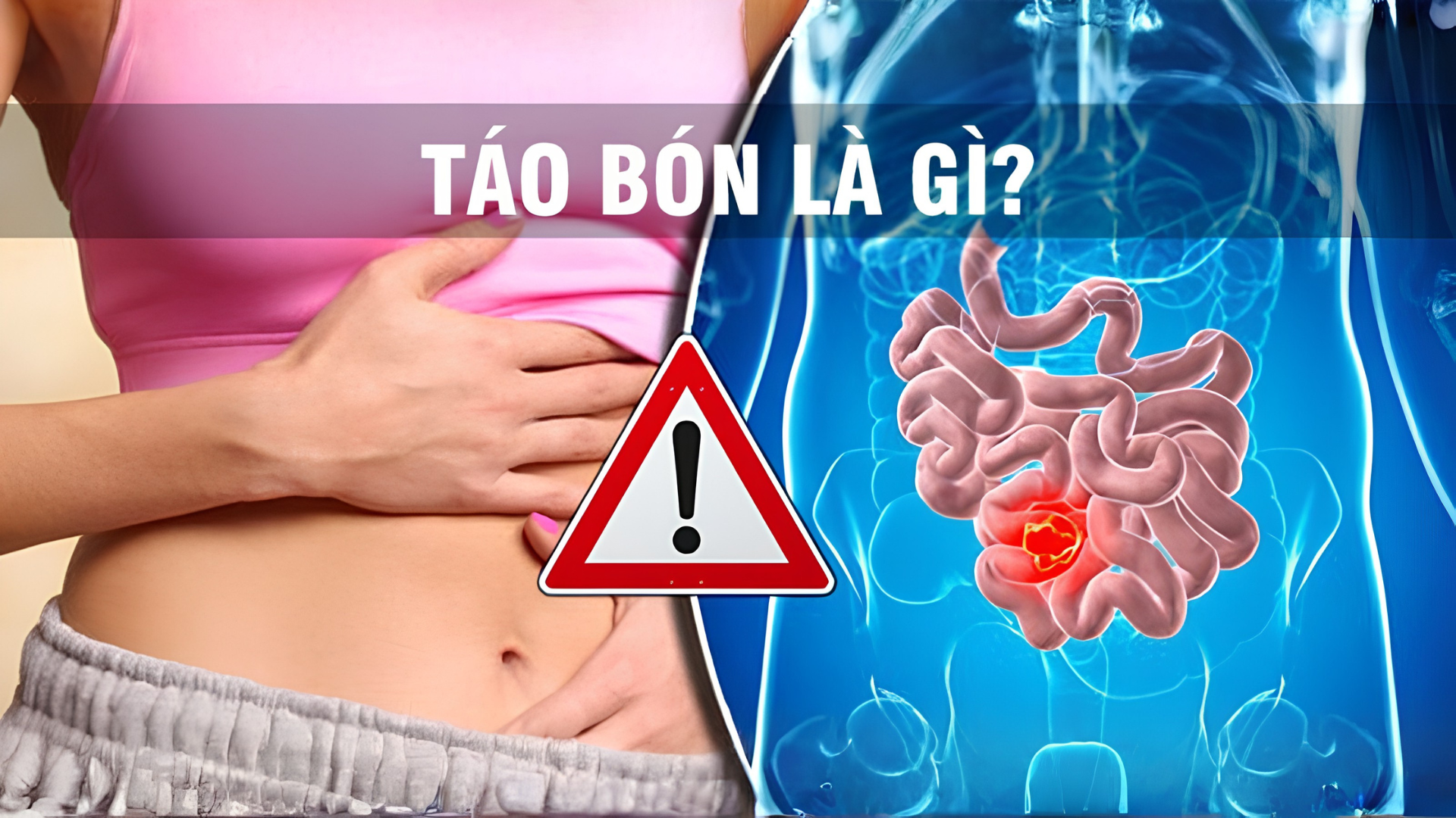 Táo bón: nguyên nhân và cách giải quyết