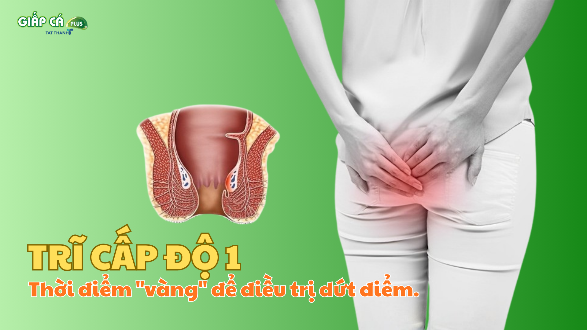 Trĩ độ 1: Thời điểm "vàng" để điều trị dứt điểm.
