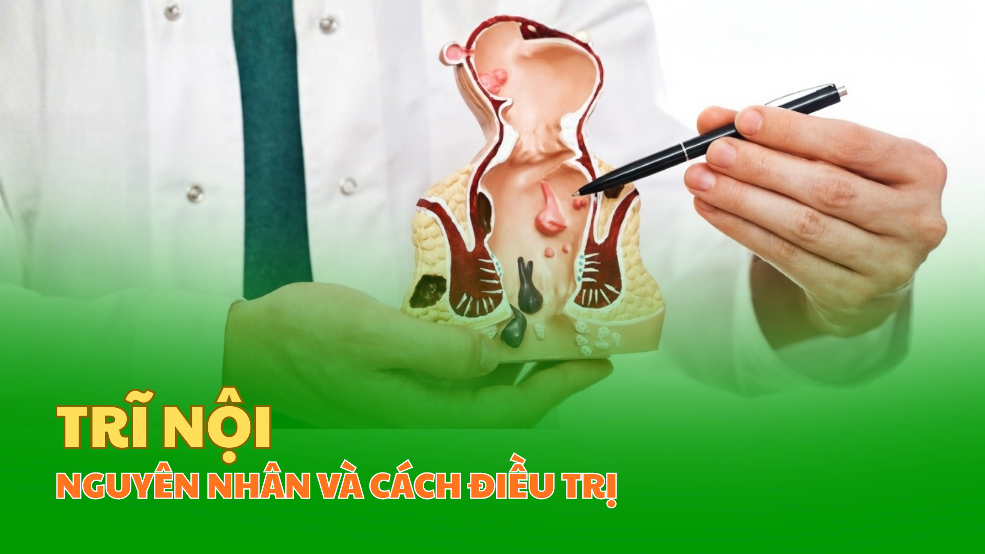 Trĩ nội là gì? Nhận biết triệu chứng, hiểu rõ nguyên nhân và cách cải thiện triệu chứng an toàn và hiệu quả