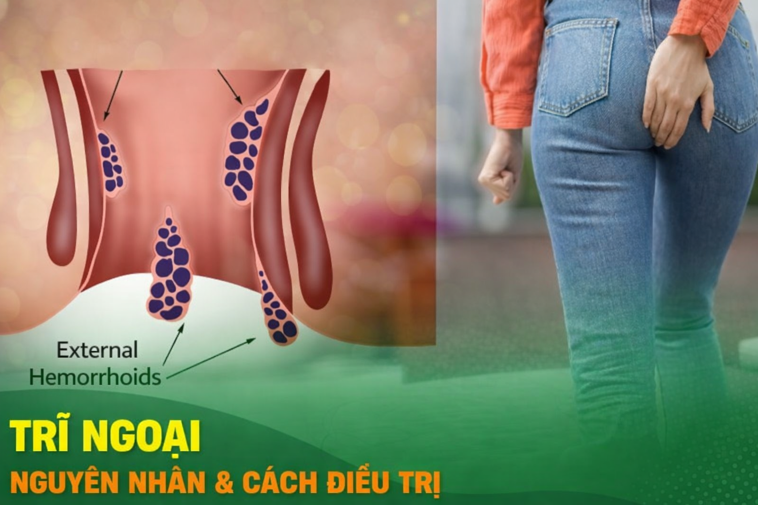 Tri-ngoai-la-gi-Nhan-biet-trieu-chung-hieu-ro-nguyen-nhan-va-cach-cai-thien-trieu-chung-an-toan-va-hieu-qua-2.png