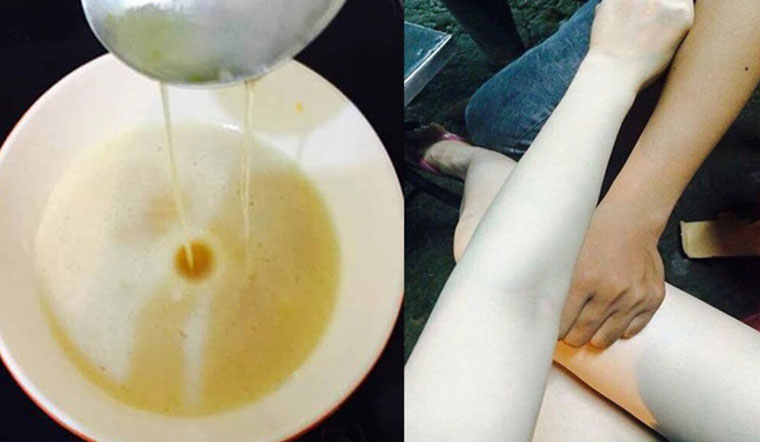 Lưu ý khi tắm trắng bằng bia và lợi ích