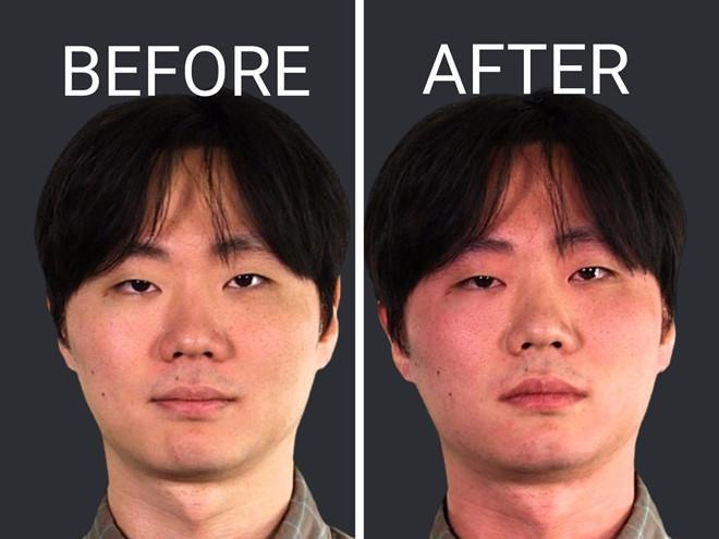 Uống bia mặt đỏ do hội chứng phổ biến ở người châu Á