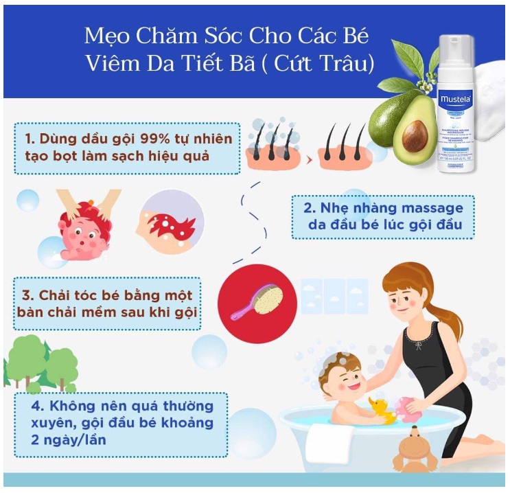 Dầu gội tạo bọt (cho da tiết bã - cứt trâu) cho trẻ sơ sinh Mustela - FOAM SHAMPOO FOR NEWBORNS 150ml