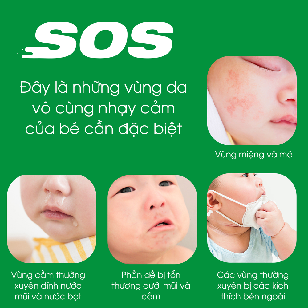 Kem phục hồi chuyên biệt SOS Cream ATONO2 cho bé từ 0M+ (20ml)