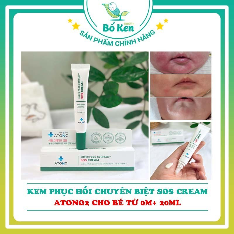 Kem phục hồi chuyên biệt SOS Cream ATONO2 cho bé từ 0M+ (20ml)