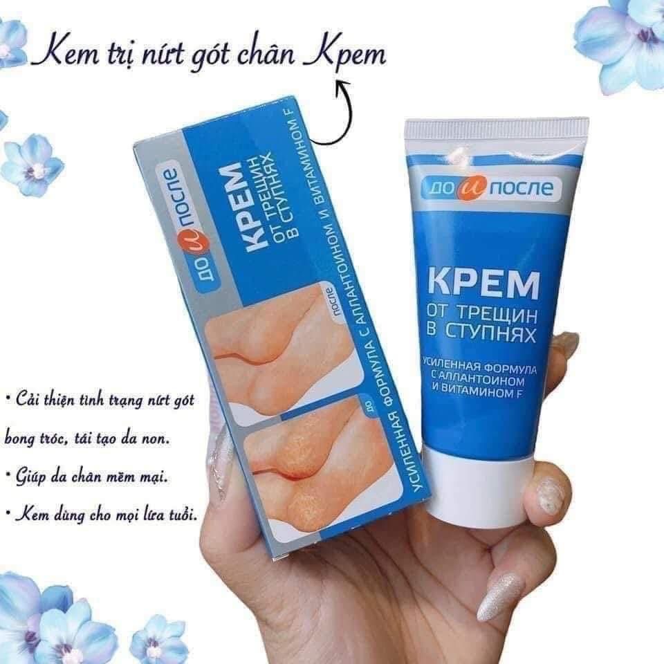 Kem bôi nứt gót chân Nga KPEM