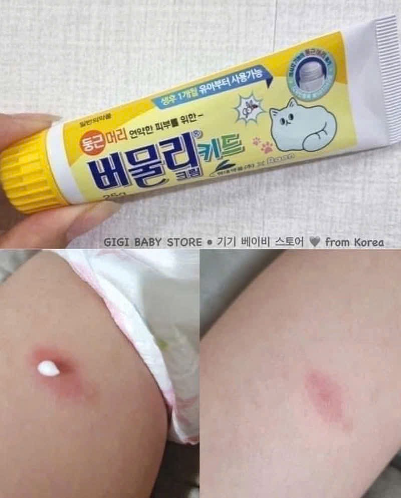 Kem bôi muỗi đốt Hàn Quốc