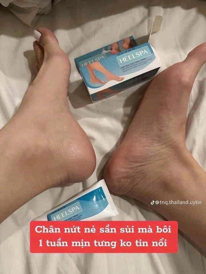 Kem bôi trị nứt gót chân Heelspa Thái Lan