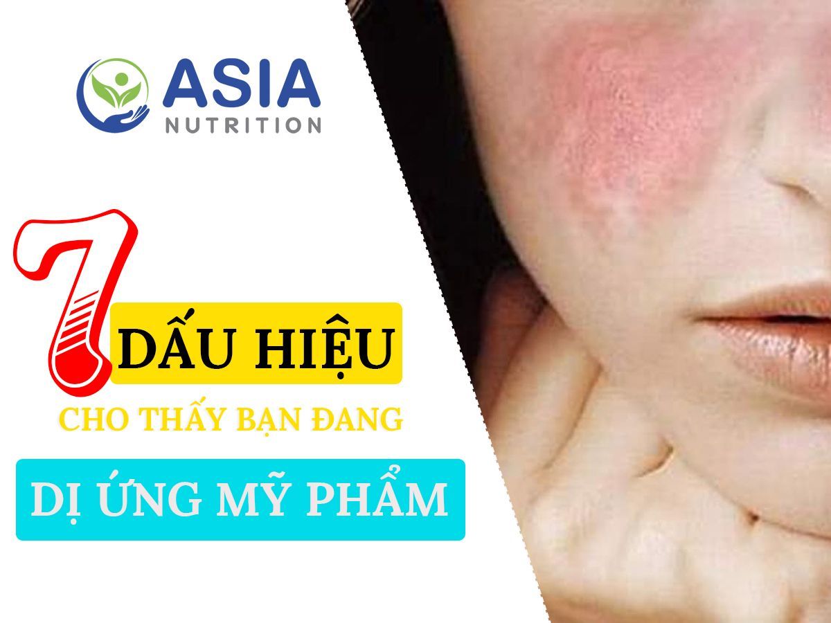 7 DẤU HIỆU CHO THẤY BẠN BỊ DỊ ỨNG MỸ PHẨM