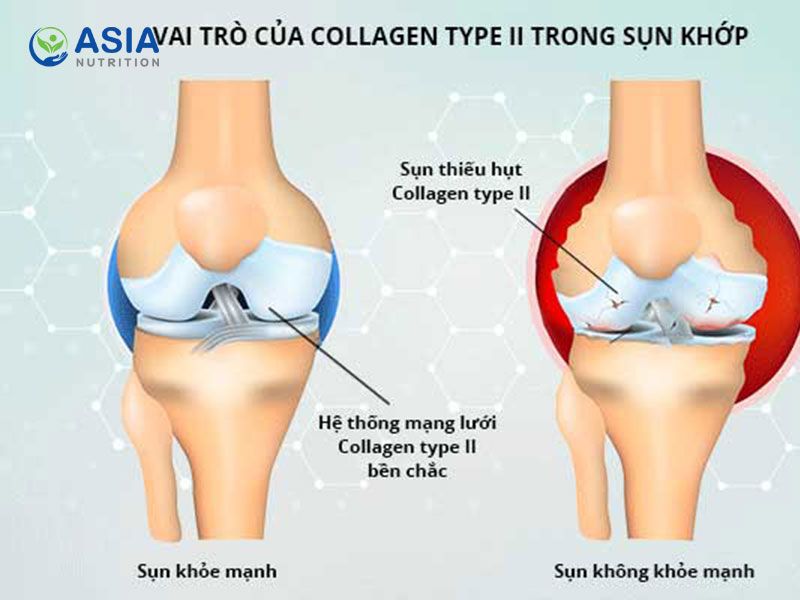 Tác dụng của collagen với cơ xương khớp rất quan trọng