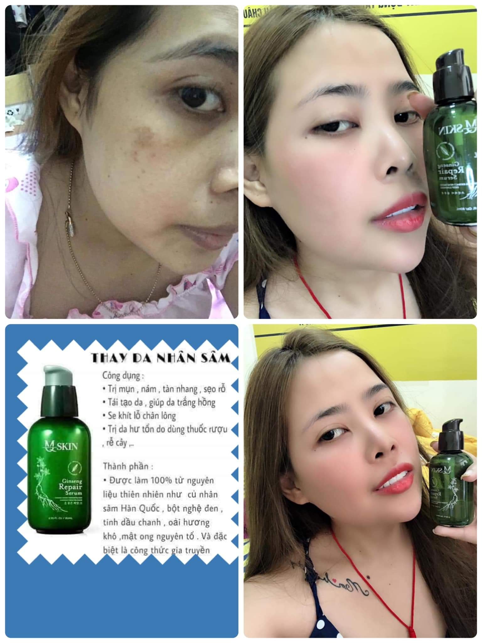 Serum Thay Da Nhân Sâm Mq Skin