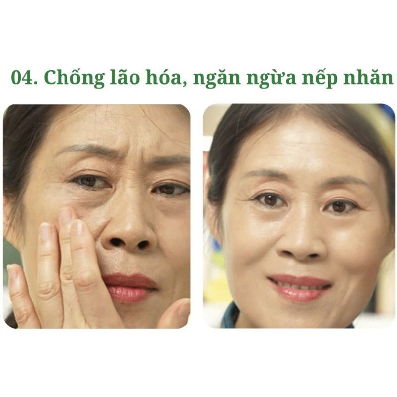 Kem dưỡng mắt Osufi