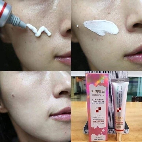 Kem Nám 3D Whitening Clinic Cream Melasma Hàn Quốc