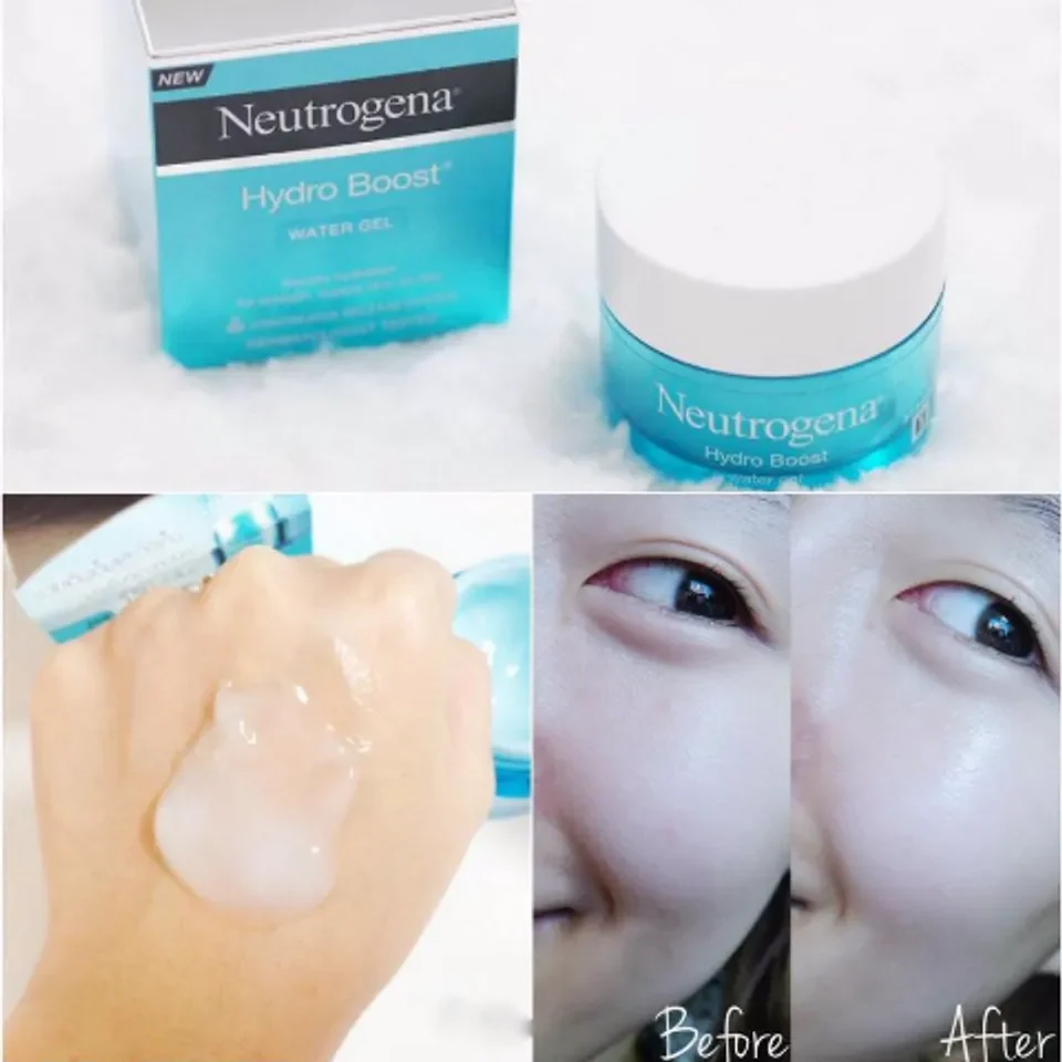 Kem Dưỡng Ẩm Neutrogena Hydro Boost Water Gel (50g)