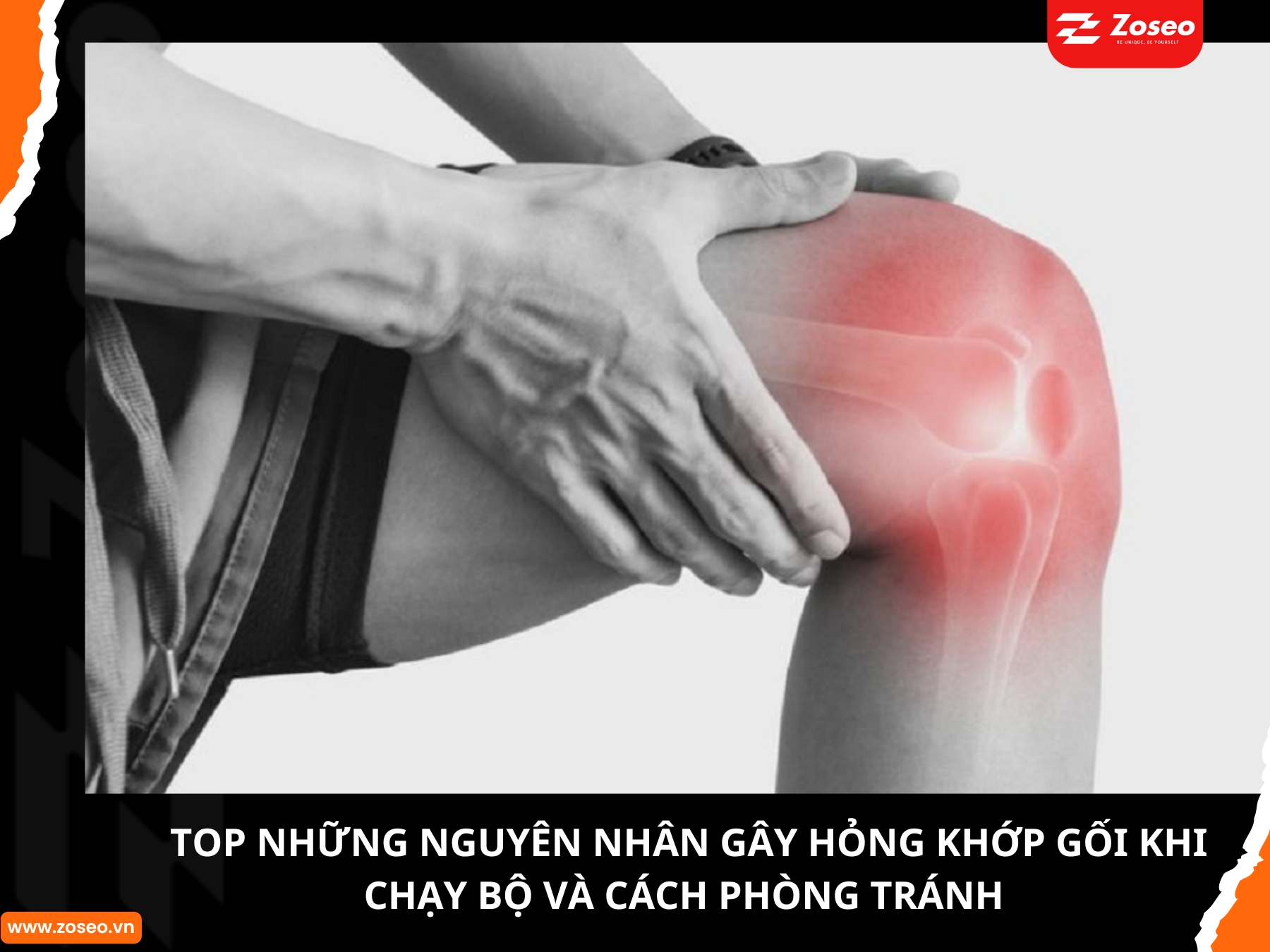 TOP những nguyên nhân gây hỏng khớp gối khi chạy bộ và cách phòng tránh