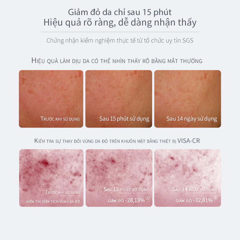 Mặt Nạ Dưỡng Ẩm Hapsode – Làm Dịu Da Nhanh Chóng, Phục Hồi Da Nhạy Cảm, Chiết Xuất Lá Ô Liu - Hộp 5 Miếng