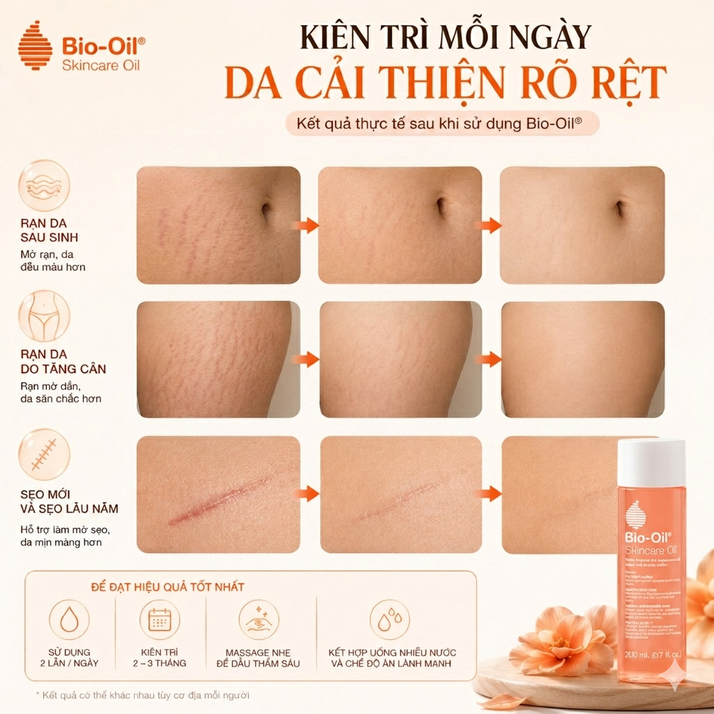 Bio-Oil-Co-Tri-Ran-Da-Sau-Sinh-Hieu-Qua-Khong--4.png