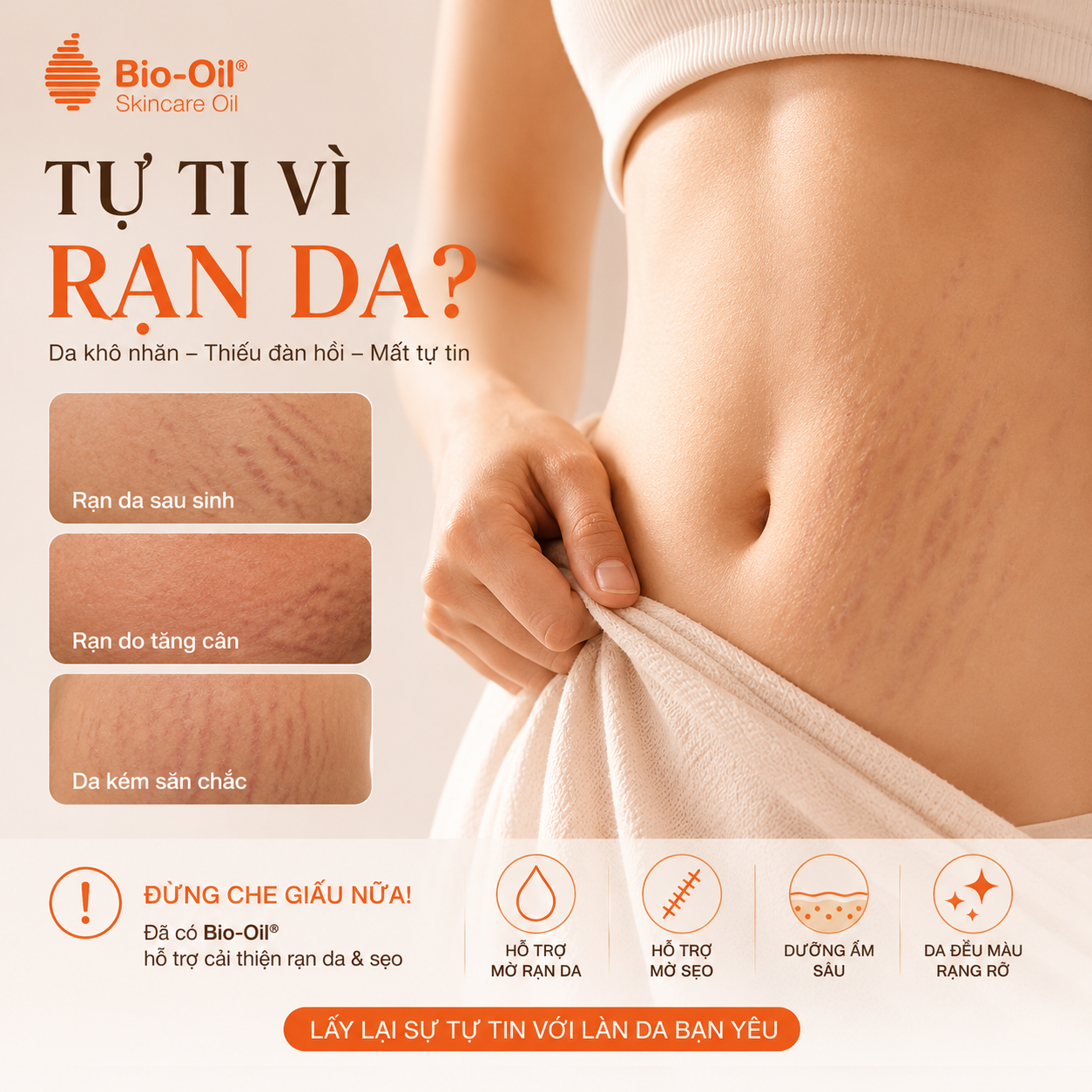 Bio-Oil-Co-Tri-Ran-Da-Sau-Sinh-Hieu-Qua-Khong--6.png