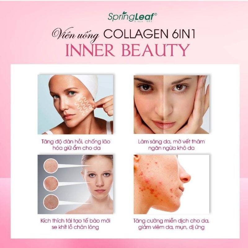 SpringLeaf Inner Beauty Collagen 6in1 Viên collagen cao cấp 6 chức năng Úc (90v)