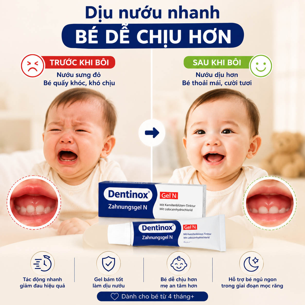 Dentinox-Gel N Zahnungshilfe Gel bôi răng lợi Đức (10g)