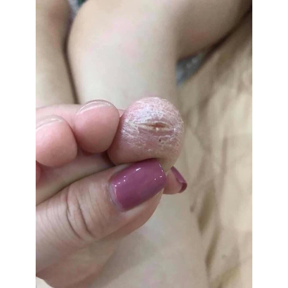 Kem Trị Nứt Nẻ Á Sừng Tay Chân Hiệu Quả HÃNG JIMINGTANG(Xanh Trắng Đeo Kính)