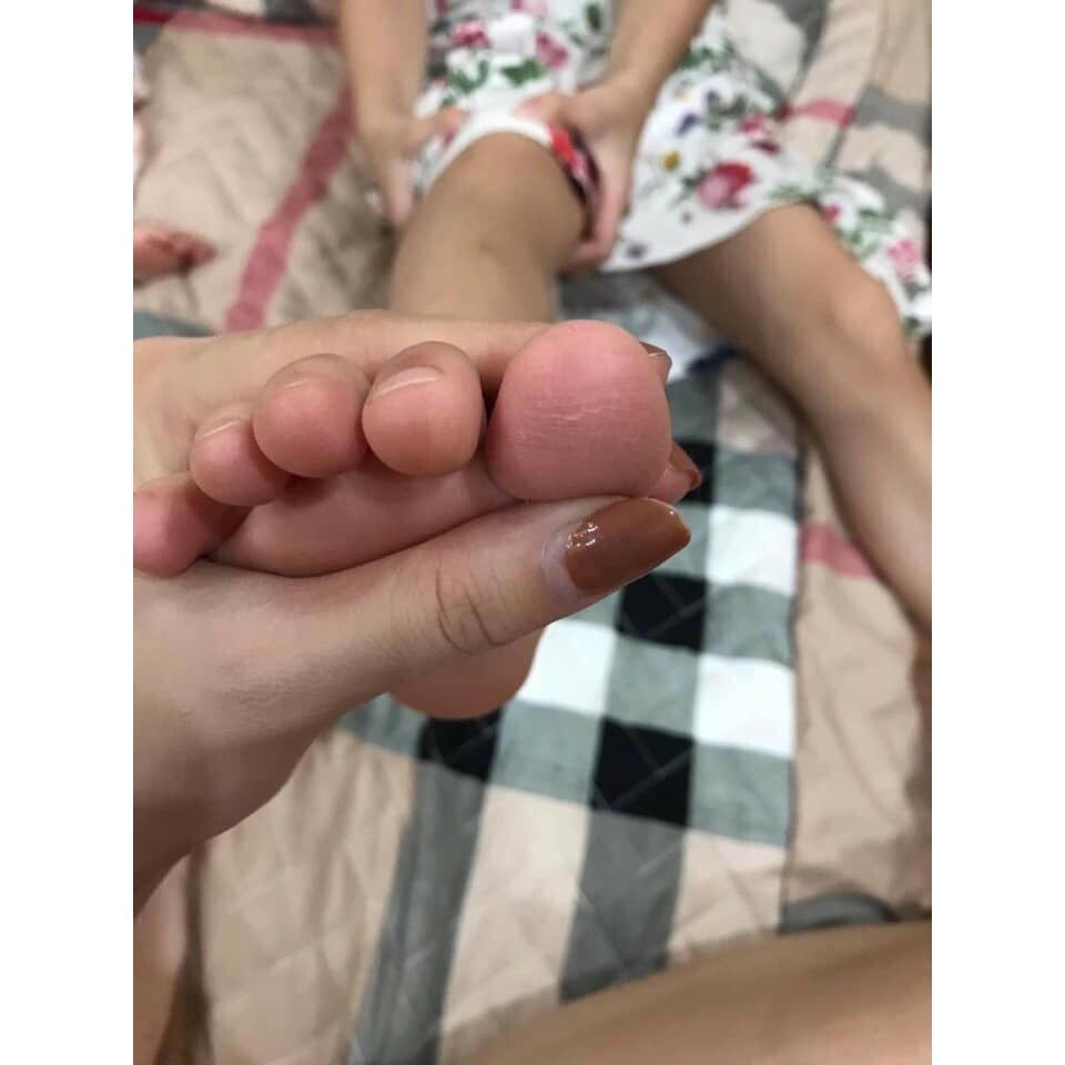 Kem Trị Nứt Nẻ Á Sừng Tay Chân Hiệu Quả HÃNG JIMINGTANG(Xanh Trắng Đeo Kính)