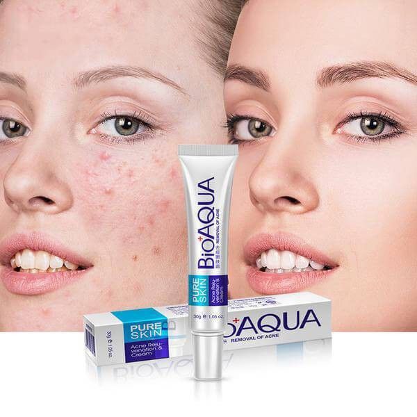 Kem Bôi Ngừa Mụn BIOAQUA BQY0719