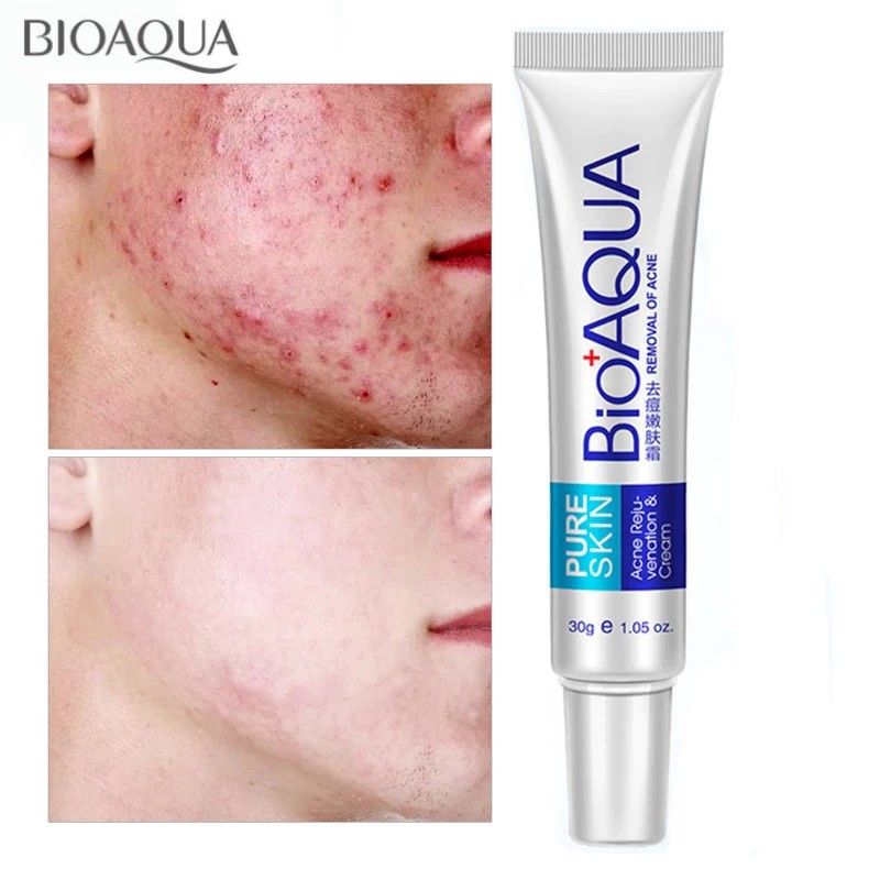 Kem Bôi Ngừa Mụn BIOAQUA BQY0719