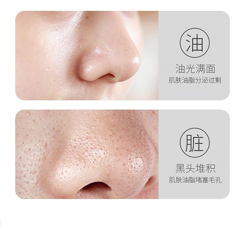 Mặt Nạ Trứng Túi Có Vòi 100g(Dạng Gel Lột)