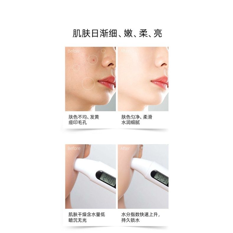 Mặt Nạ Trứng Túi Có Vòi 100g(Dạng Gel Lột)