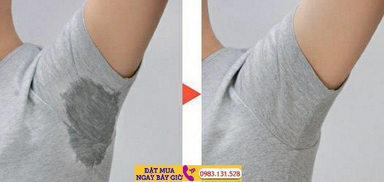 COMBO 10 Gói Miếng Dán Nách Thấm Hút Mồ Hôi(1 GÓI CÓ 2 MIẾNG)