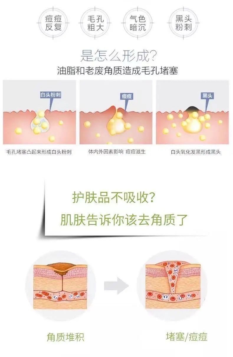 Gel Tẩy Da Chết Mặt Và Body GINBI Chiết Xuất Nha Đam 100g