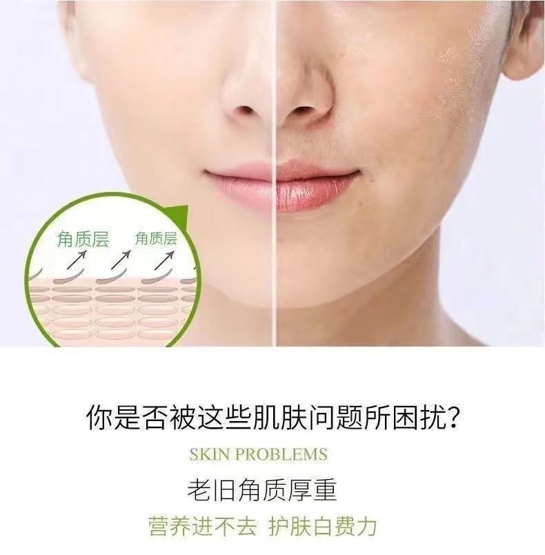 Gel Tẩy Da Chết Mặt Và Body GINBI Chiết Xuất Nha Đam 100g