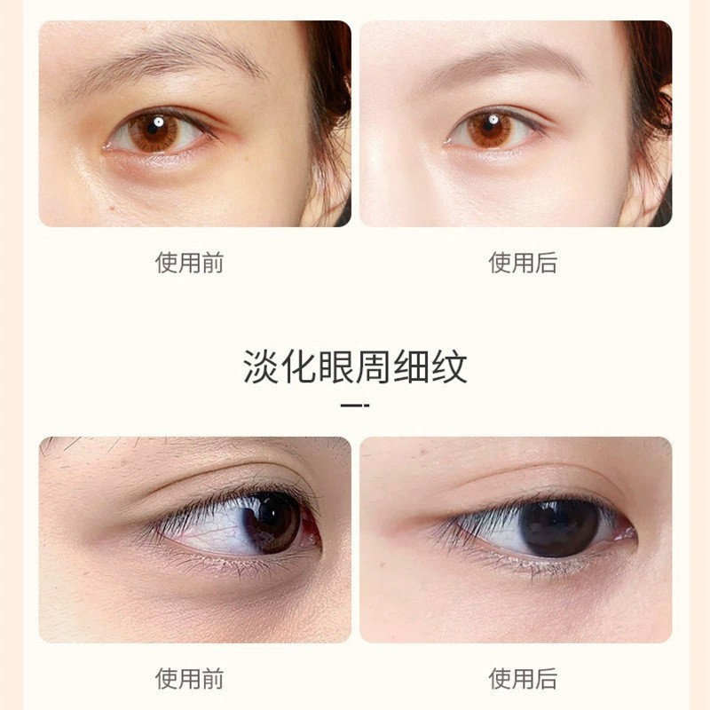 Kem Mắt Xóa Nếp Nhăn SHIROADA 8ml MV6687