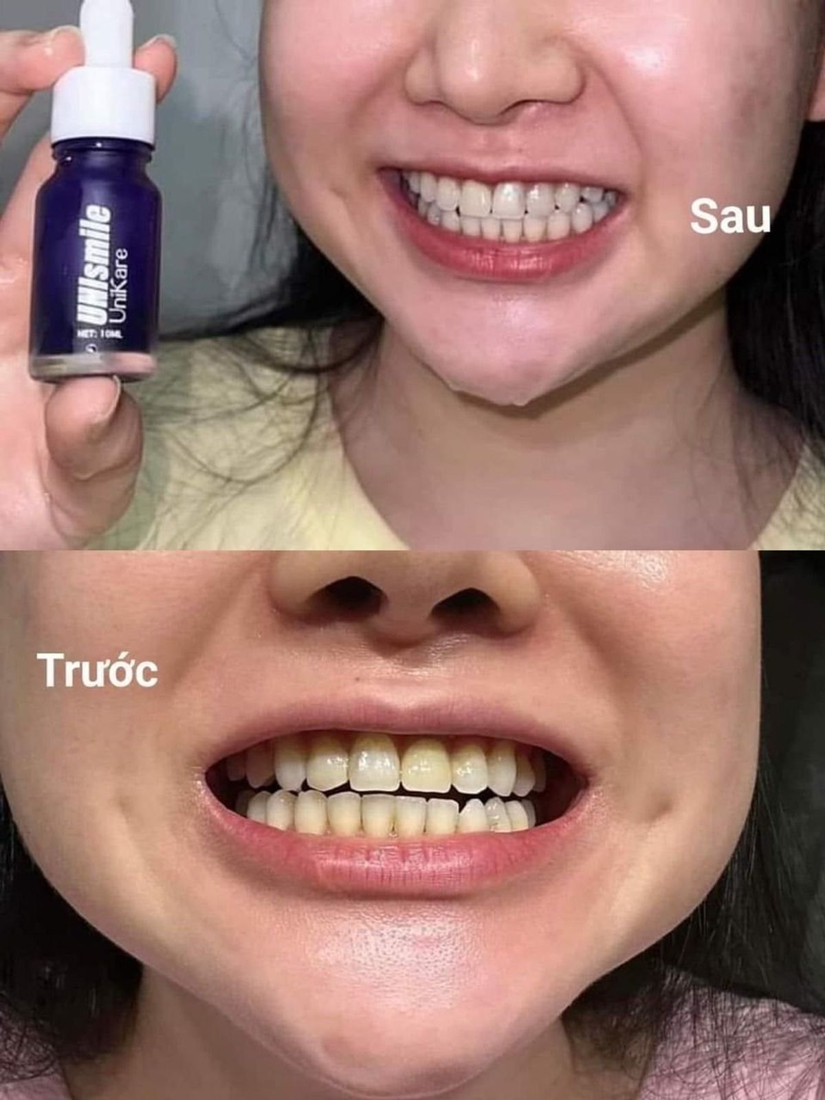 Serum Trắng Răng UNIsmile 10ml