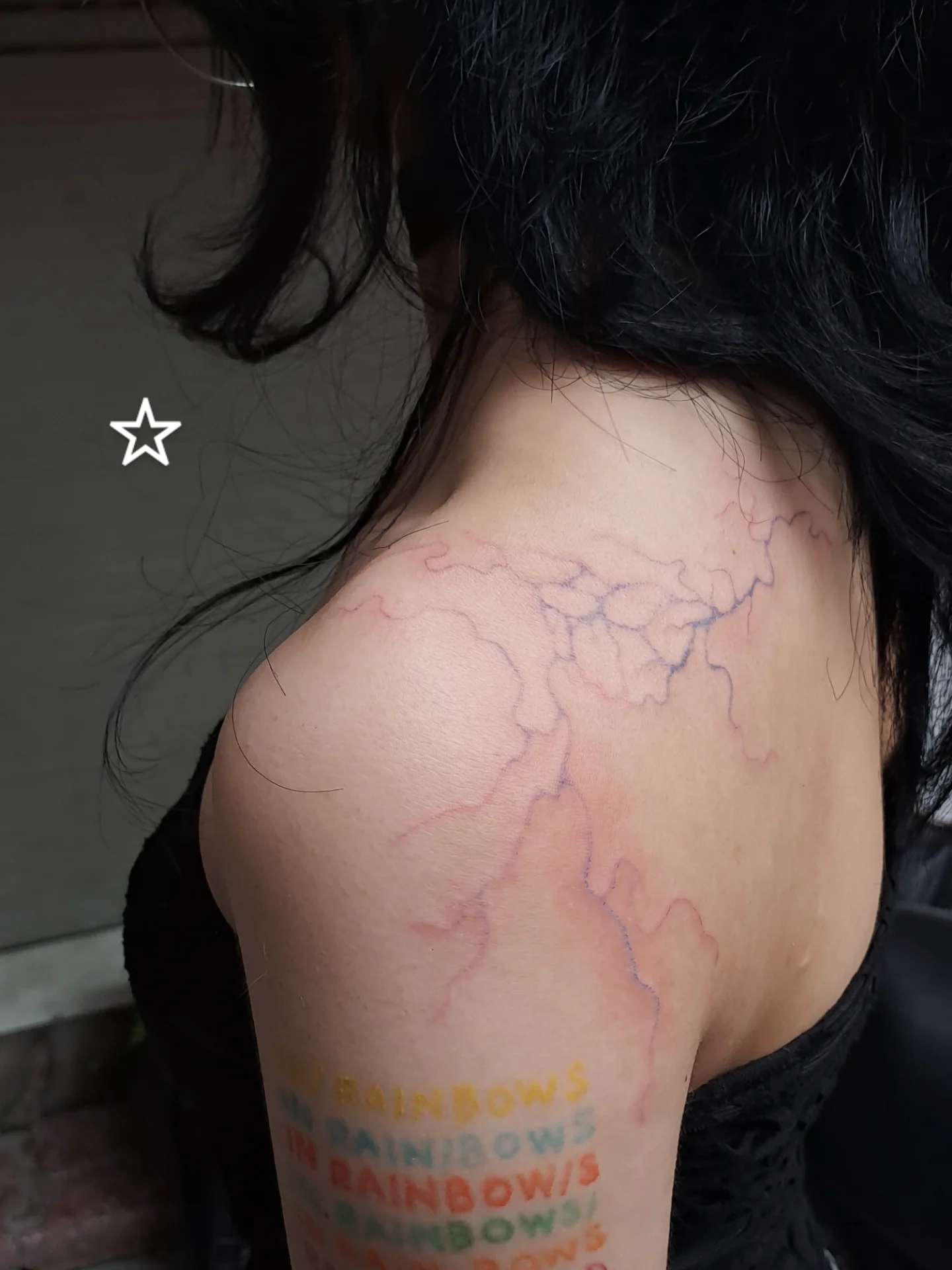 Blood Vessels