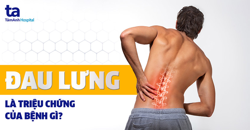 Đau lưng: Nguyên nhân, Triệu chứng và Cách chẩn đoán 