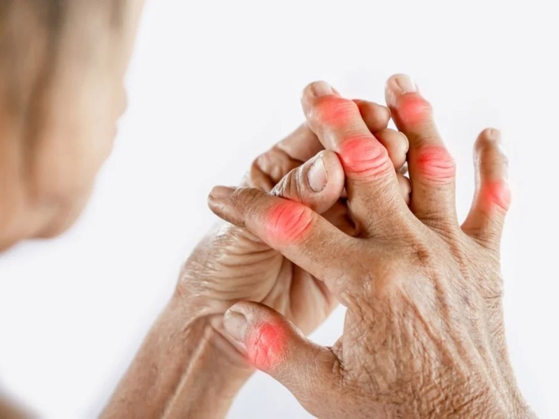 Mách bạn 10 bài thuốc nam trị viêm khớp hiệu quả và an toàn được sử dụng phổ biến hiện nay 