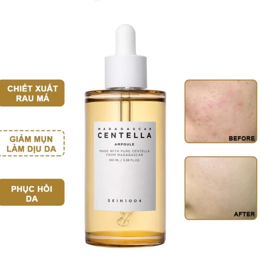 Serum rau má Madagascar SKin1004 Centella Asiatica