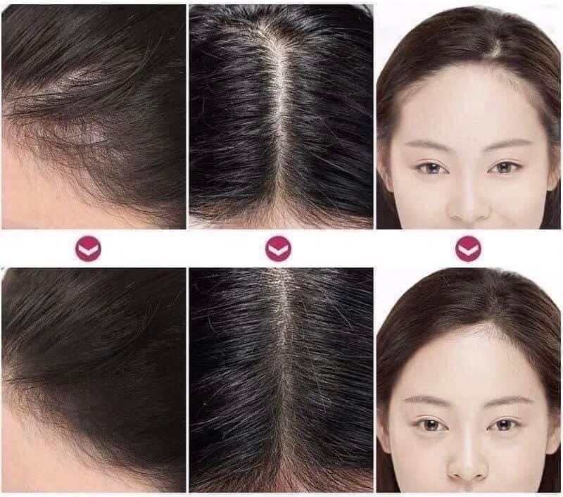 Phấn che khuyết điểm tóc dạng lăn Luk Fixx The Hair Tok Tok