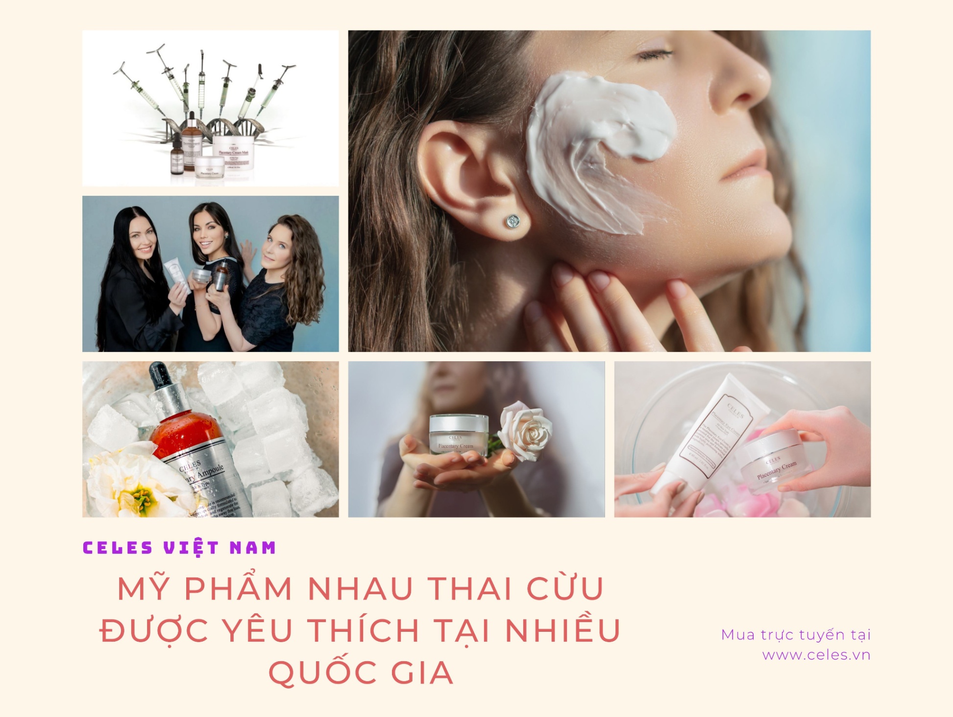 celes được yêu thích ở nhiều quốc gia