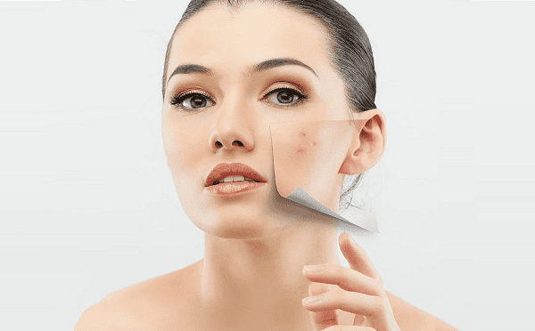 Những hiểu lầm cần loại bỏ khi chăm sóc da mụn