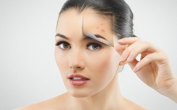 Chia sẻ 10 cách trị thâm mụn hiệu quả ngay tức tốc