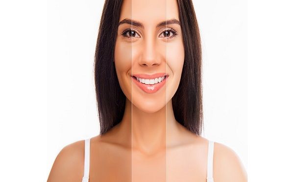 Phân biệt sự khác nhau giữa whitening (làm trắng da) và brightening (làm sáng da)