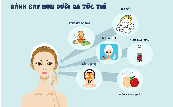 Đánh bay mụn tuổi dậy thì tận gốc với những sản phẩm trị mụn nào ?