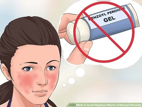 Tác dụng phụ của Benzoyl Peroxide